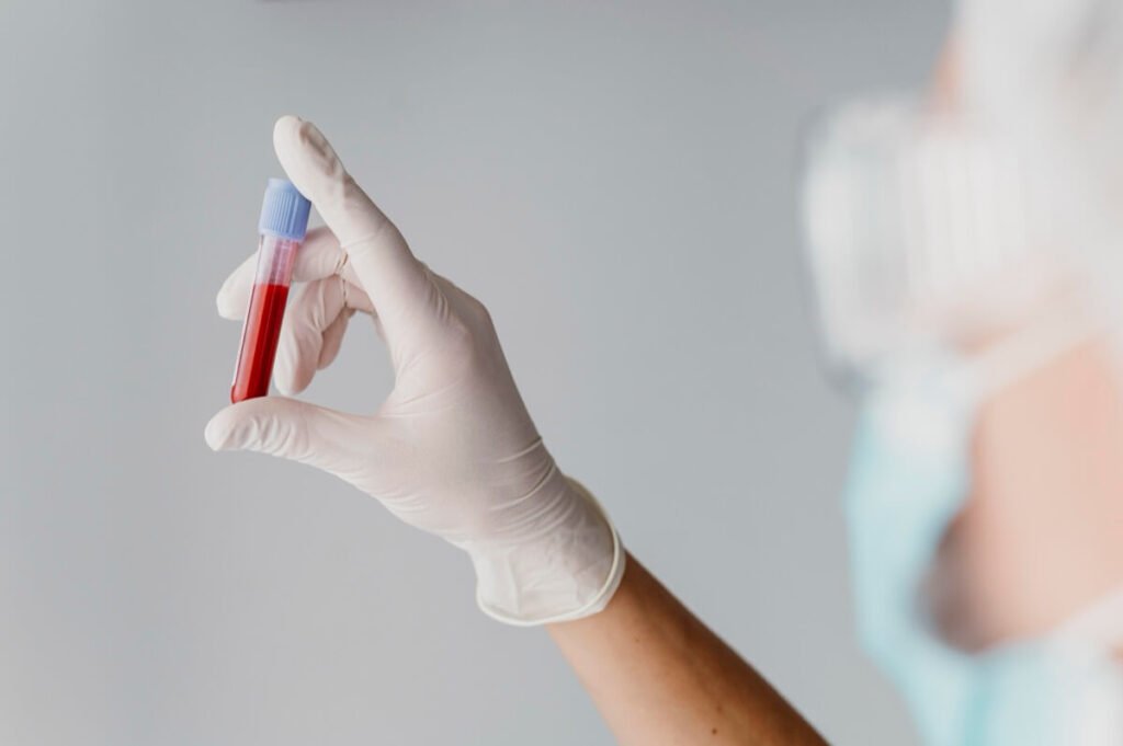 Koniecznie wykonaj kontrolne laboratoryjne badania krwi przed wprowadzeniem jadłospisu keto!